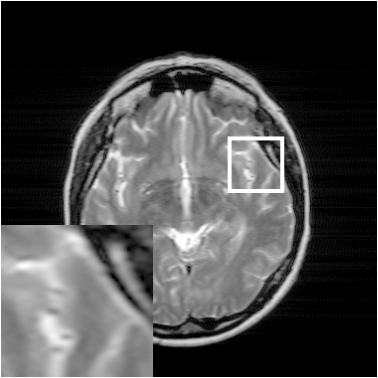 Figure 25