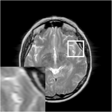 Figure 26
