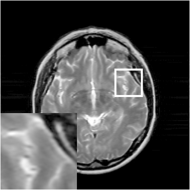 Figure 29