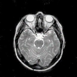 Figure 34