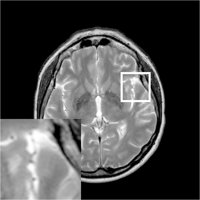 Figure 37