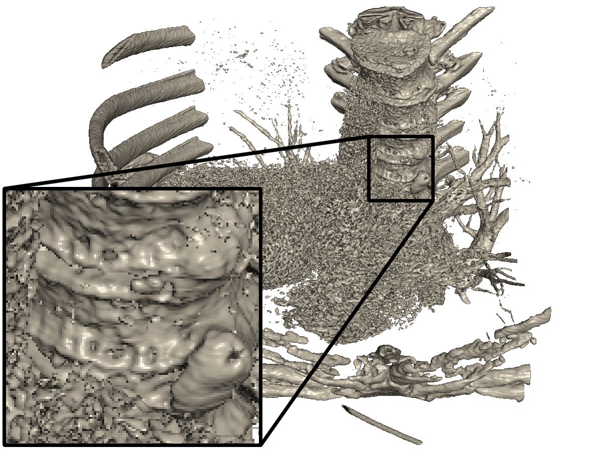 Figure 25