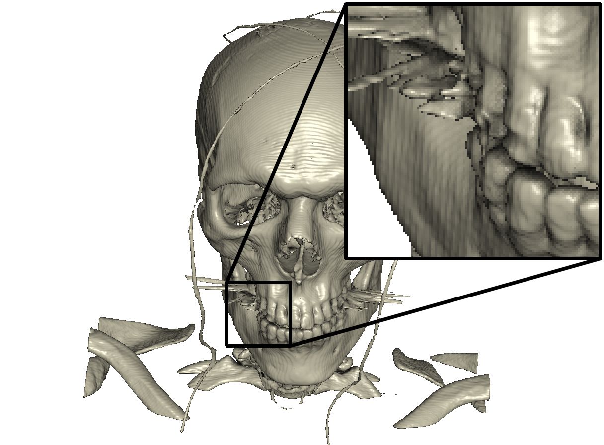 Figure 32