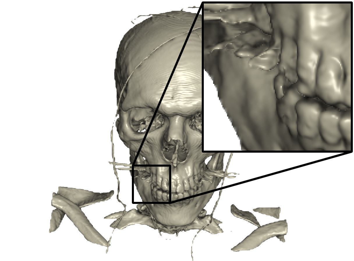 Figure 33