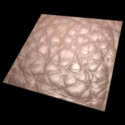 Figure 32