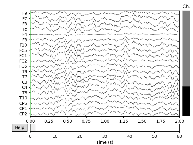 Figure 20