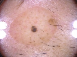 Figure 16