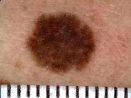 Figure 17