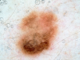 Figure 18