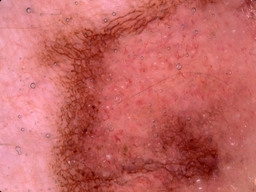 Figure 19