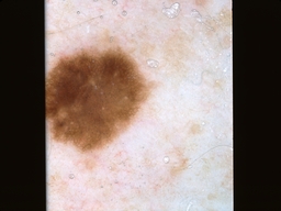 Figure 23