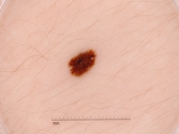 Figure 24