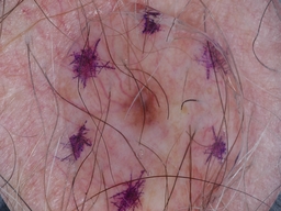 Figure 26