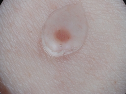 Figure 27