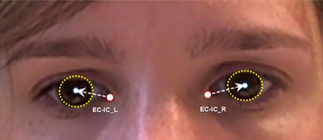 Figure 32