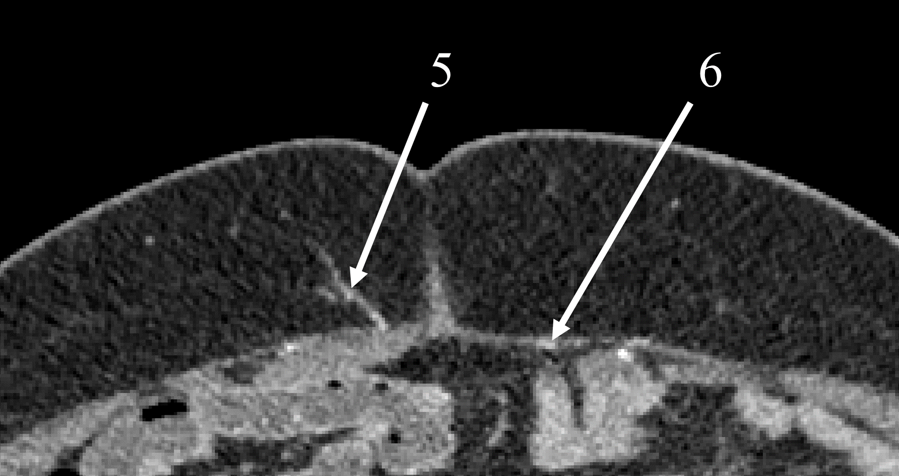 Figure 20