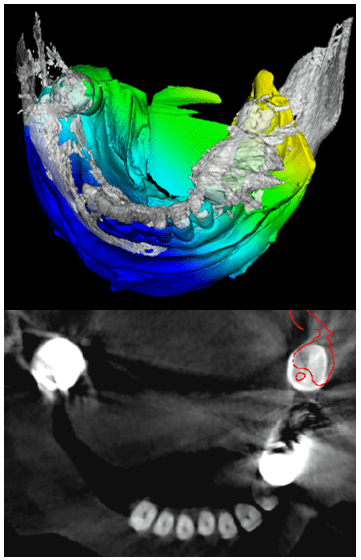 Figure 11