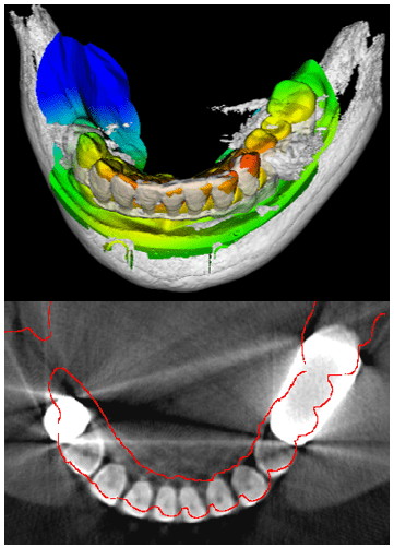 Figure 12