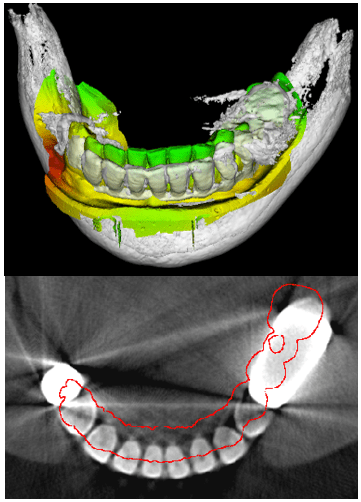 Figure 13