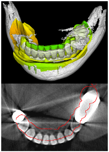 Figure 14