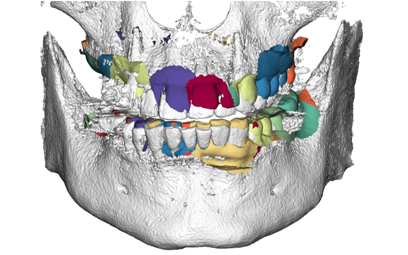 Figure 21