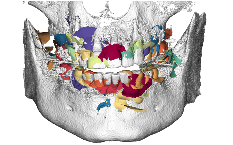 Figure 22
