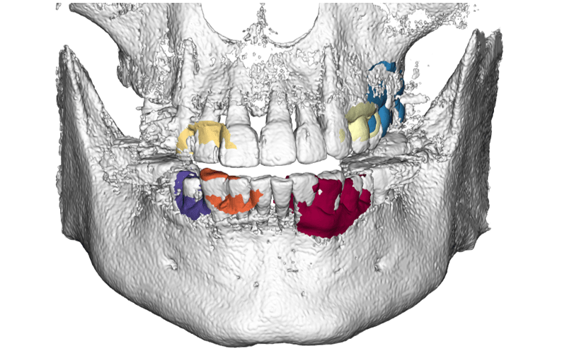 Figure 23