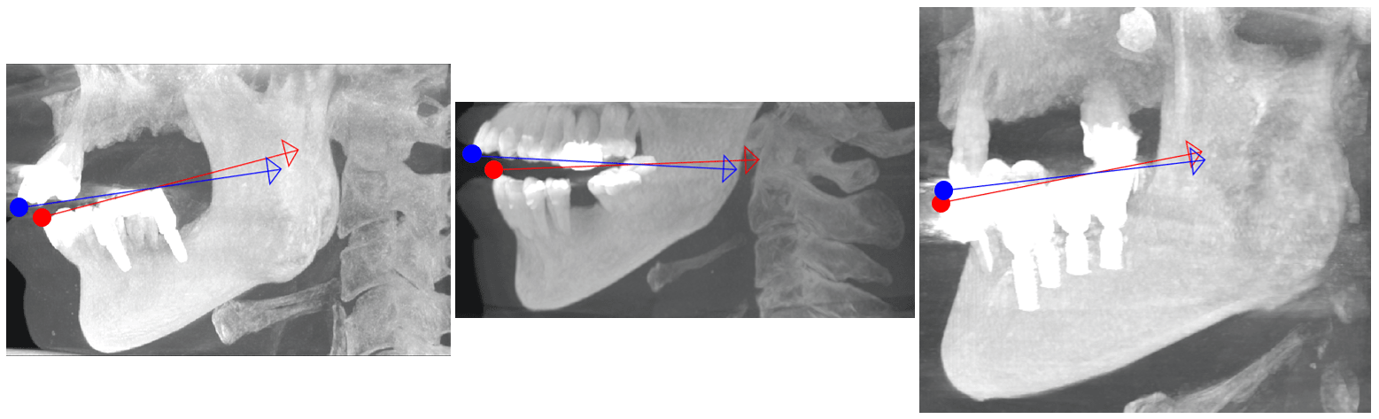 Figure 29