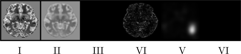 Figure 23