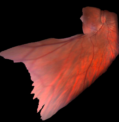 Figure 14