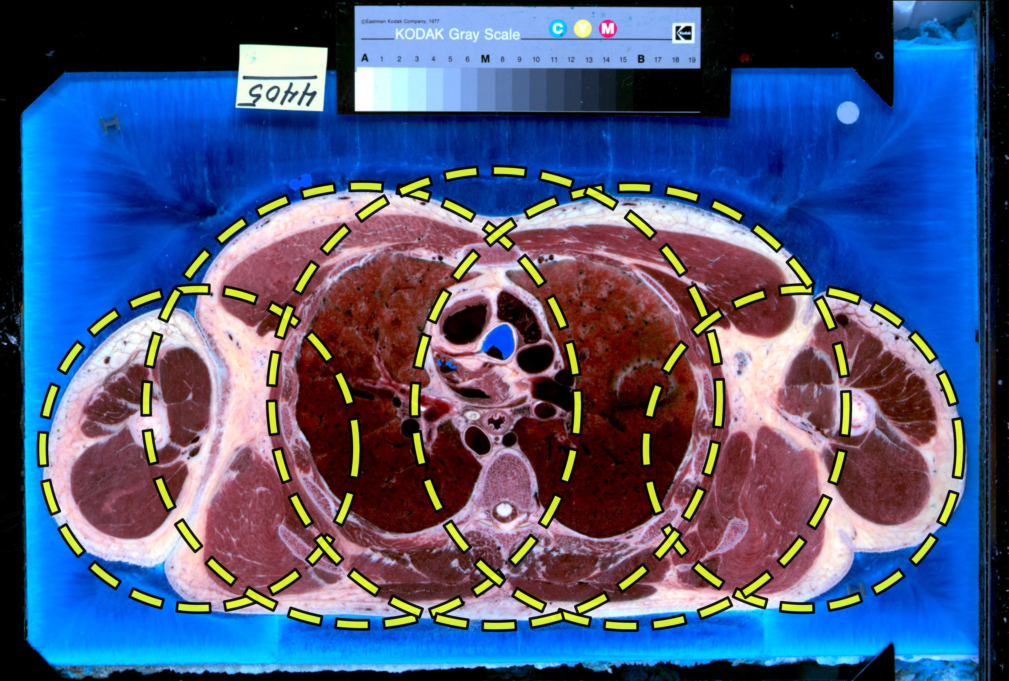 Figure 11
