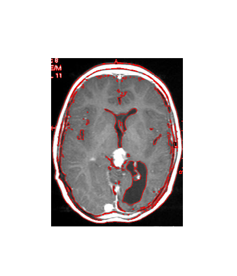 Figure 10