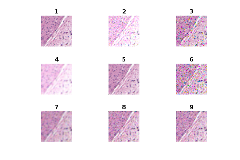 Figure 11