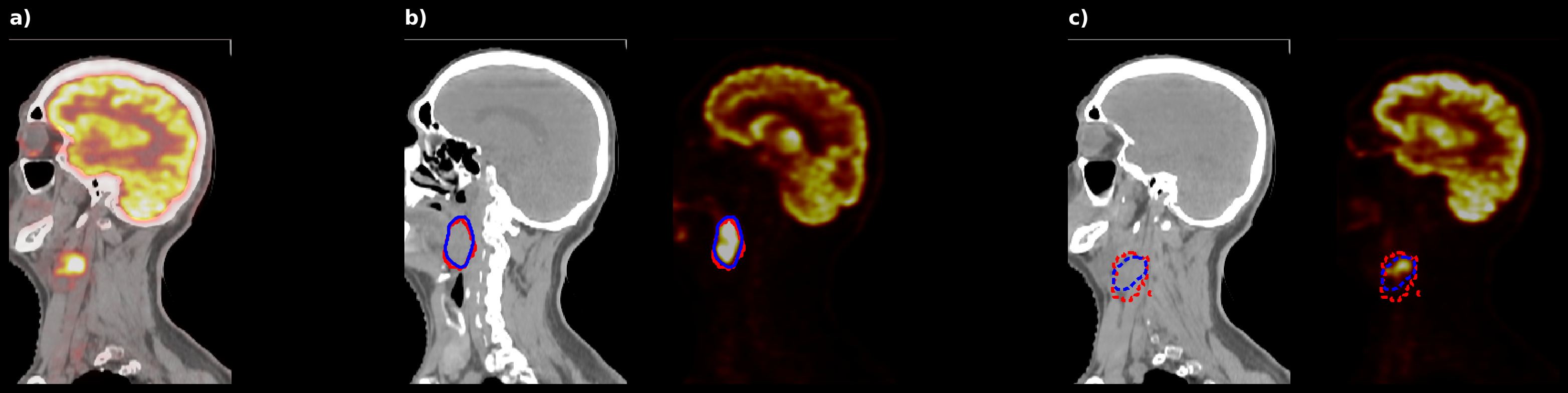 Figure 21