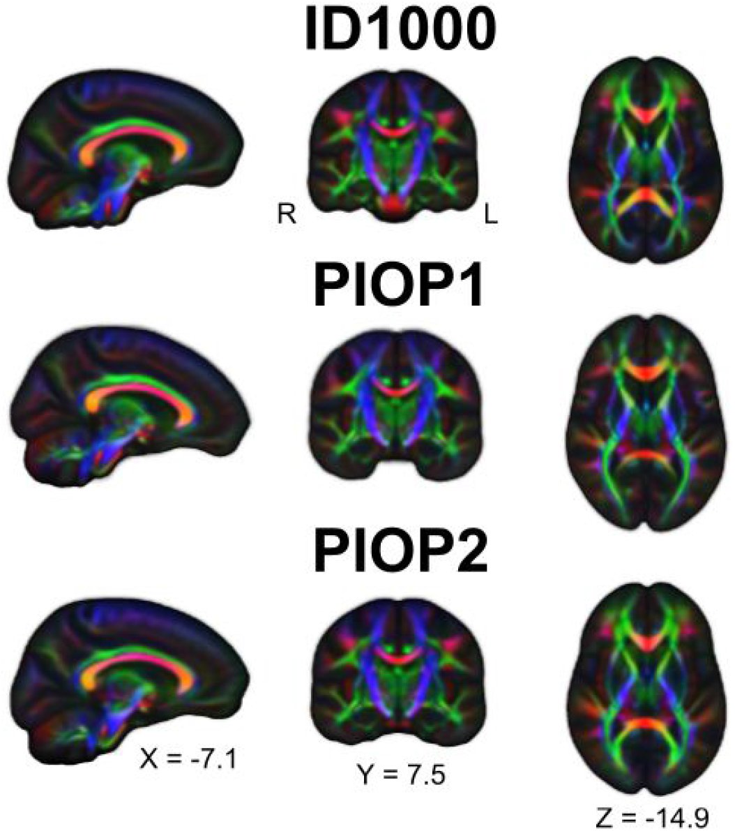 Figure 11