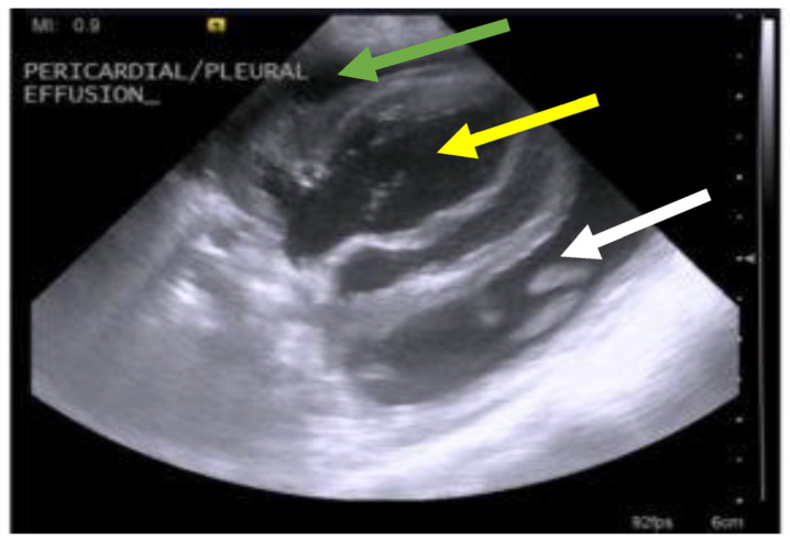 Figure 17