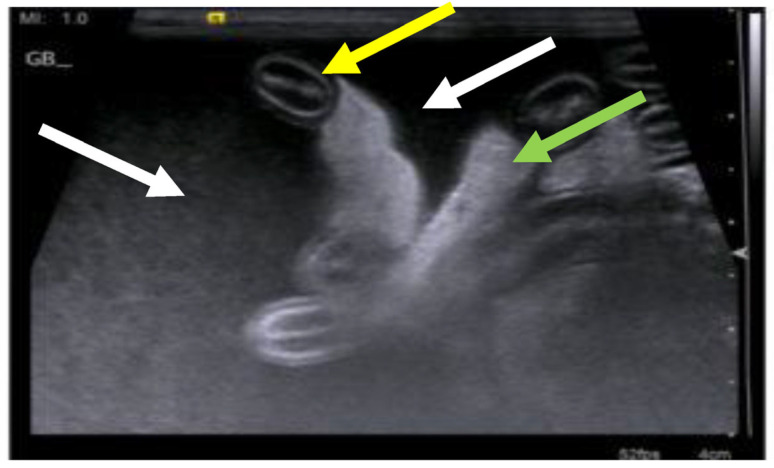Figure 18