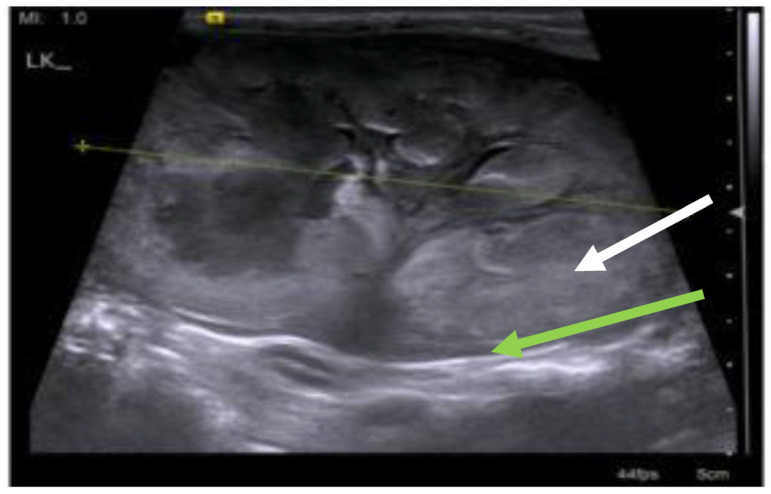 Figure 20