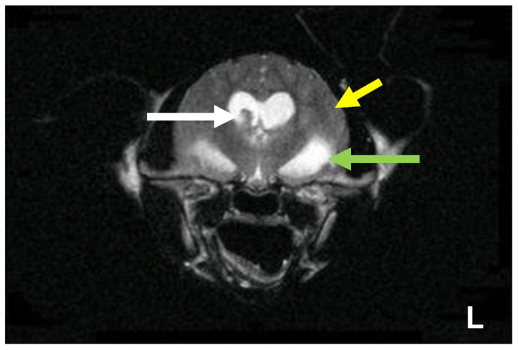 Figure 22