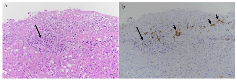 Figure 23