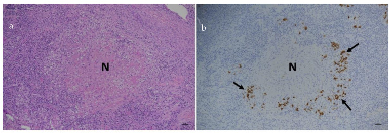Figure 25