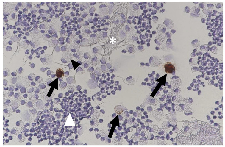 Figure 30