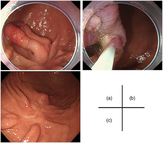 FIGURE 3