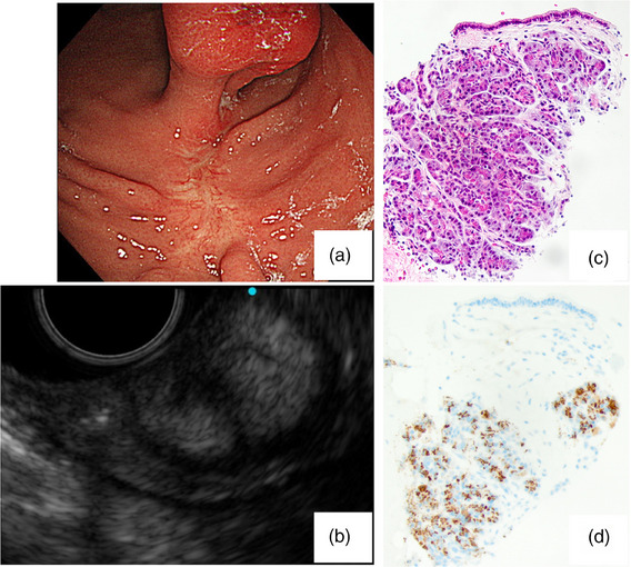 FIGURE 2