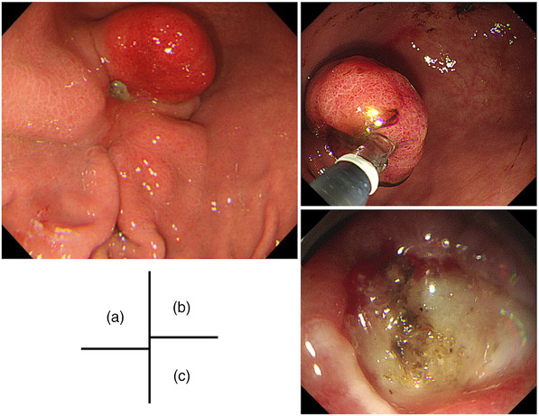 FIGURE 1