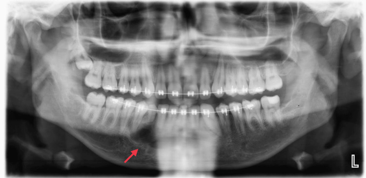 Figure 5