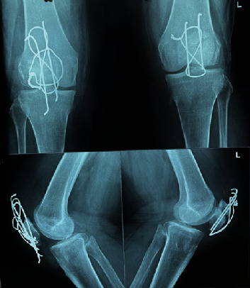 Figure 4
