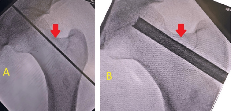 Figure 9