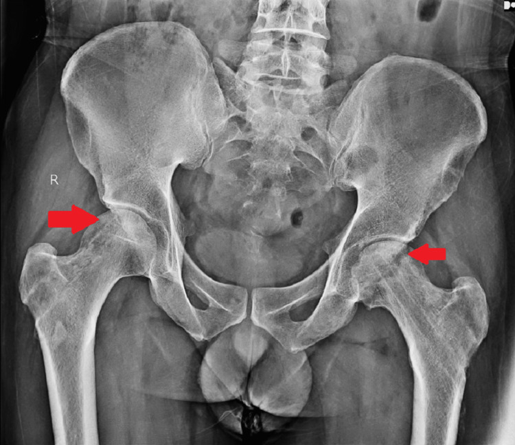 Figure 11
