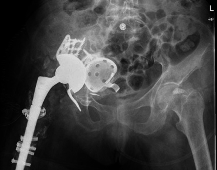 Figure 6
